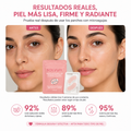 Tratamiento para ojeras Solviay