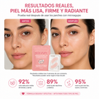 Tratamiento para ojeras Solviay
