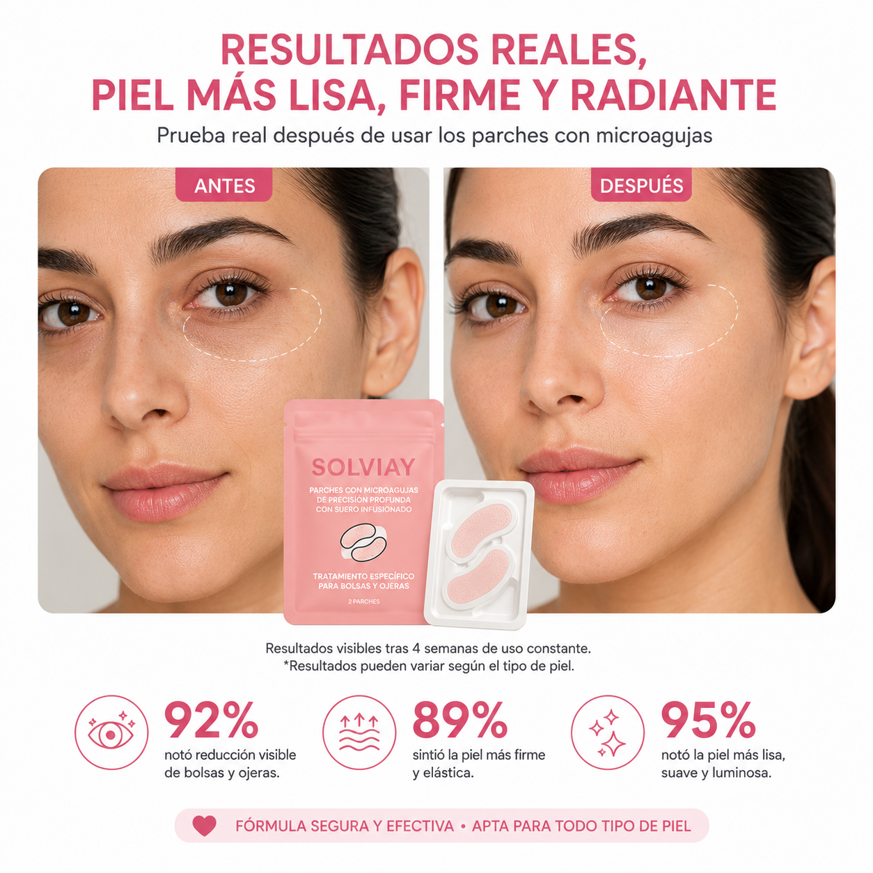 Tratamiento para ojeras Solviay