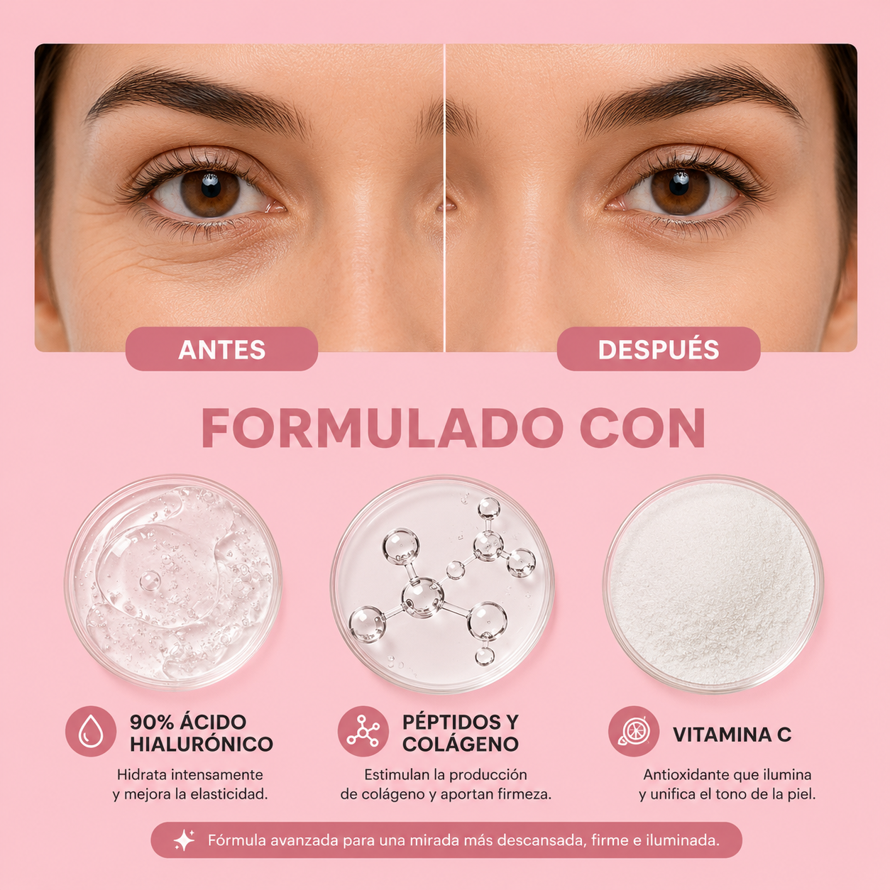 Tratamiento para ojeras Solviay