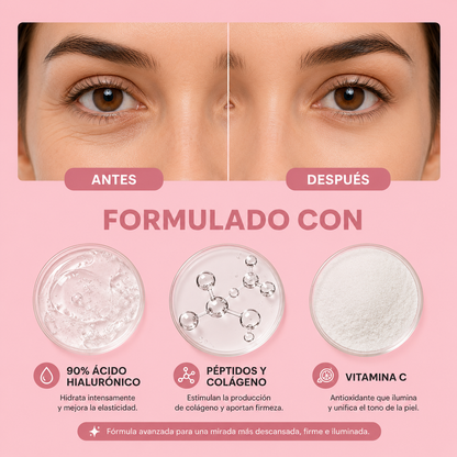 Tratamiento para ojeras Solviay